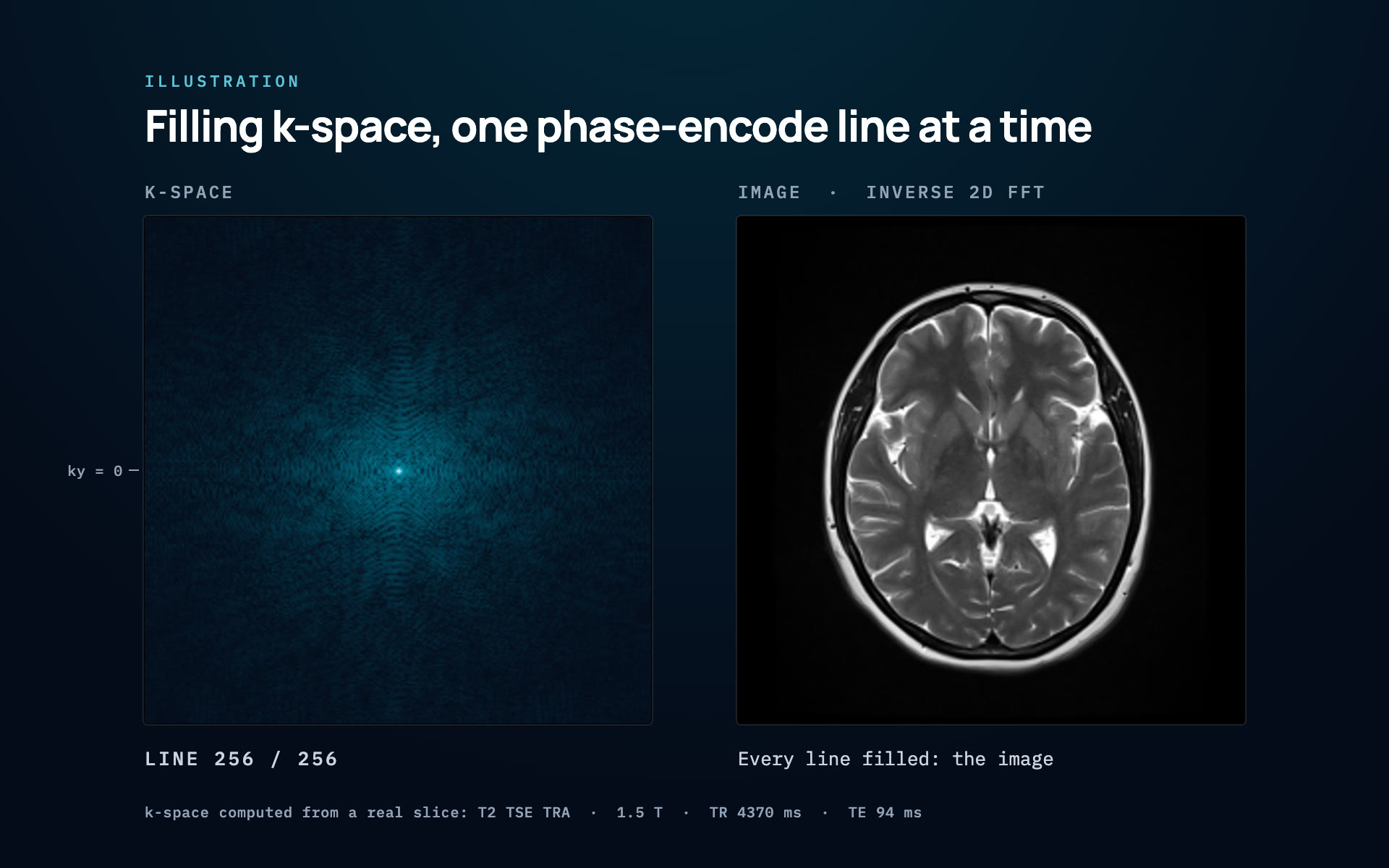 K-space filled line by line beside the brain image it reconstructs: edges only until the centre line is read, then contrast, then fine detail